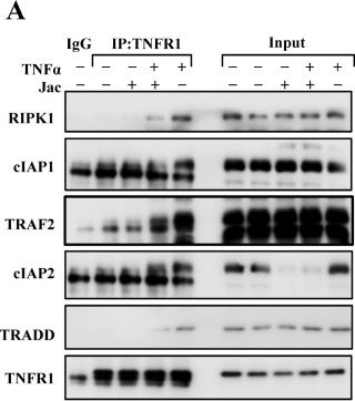 Fig.5.A showing Western Blotting in a Homo sapiens (Human) sample from the publication: Modulation of TNFR 1-Triggered Inflammation and Apoptosis Signals by Jacaranone in Cancer Cells.