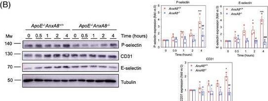 Fig.7.B showing Western Blotting in a Mus musculus (House mouse) sample from the publication: Annexin A8 deficiency delays atherosclerosis progression.