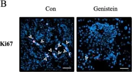 Fig.4.B showing Immunohistochemistry-immunofluorescence in a Mus musculus (House mouse) sample from the publication: Dietary intake of genistein suppresses hepatocellular carcinoma through AMPK-mediated apoptosis and anti-inflammation.