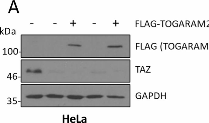 Fig.9.A showing Western Blotting in a Homo sapiens (Human) sample from the publication: The Hippo pathway transcription factors YAP and TAZ play HPV-type dependent roles in cervical cancer.