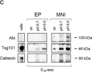 Fig.3.C showing Western Blotting from the publication: Acidic microenvironment plays a key role in human melanoma progression through a sustained exosome mediated transfer of clinically relevant metastatic molecules.