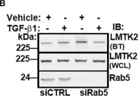 Fig.4.B showing Western Blotting in a Homo sapiens (Human) sample from the publication: TGF-β1 Augments the Apical Membrane Abundance of Lemur Tyrosine Kinase 2 to Inhibit CFTR-Mediated Chloride Transport in Human Bronchial Epithelia.
