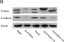 Fig.3.B showing Western Blotting from the publication: N-terminal 1-54 amino acid sequence and Armadillo repeat domain are indispensable for P120-catenin isoform 1A in regulating E-cadherin.