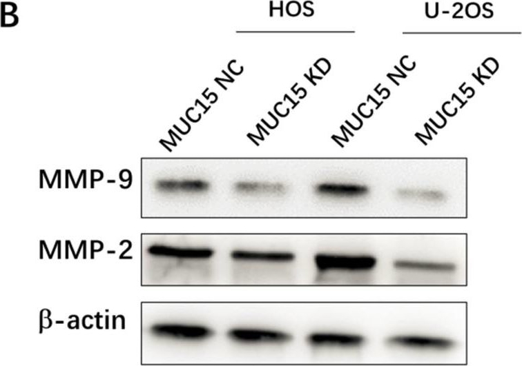 Fig.3.B showing Western Blotting in a Homo sapiens (Human) sample from the publication: MUC 15 Promotes Osteosarcoma Cell Proliferation, Migration and Invasion through Livin, MMP-2/MMP-9 and Wnt/β-Catenin Signal Pathway.