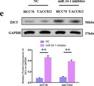 Fig.5.E showing Western Blotting in a Homo sapiens (Human) sample from the publication: LncRNA IGBP1-AS1/miR-24-1/ZIC3 loop regulates the proliferation and invasion ability in breast cancer.