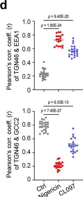 Fig.7.D from the publication: Distinct changes in endosomal composition promote NLRP3 inflammasome activation.
