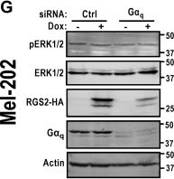 Fig.4.G showing Western Blotting in a Homo sapiens (Human) sample from the publication: Regulator of G protein signaling 2 inhibits Gαq-dependent uveal melanoma cell growth.