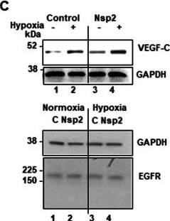 Fig.5.C showing Western Blotting in a Homo sapiens (Human) sample from the publication: SARS-CoV-2 viral protein Nsp2 stimulates translation under normal and hypoxic conditions.