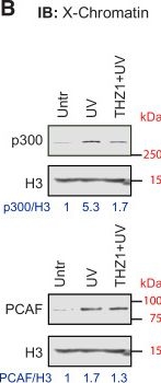 Fig.4.B showing Western Blotting from the publication: Crosstalk between chromatin state and ATM signalling in DNA damage-induced transcription stress.