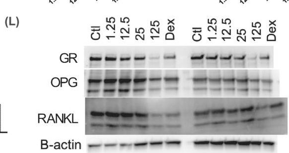 Fig.4.L showing Western Blotting in a Mus musculus (House mouse) sample from the publication: Naphthenic acid fraction components from oil sands process-affected water from the Athabasca Oil Sands Region impair murine osteoblast differentiation and function.