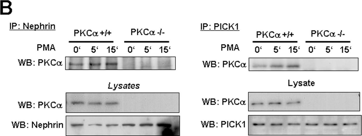 Podocytic PKC-alpha is regulated in murine and human diabetes and mediates nephrin endocytosis.