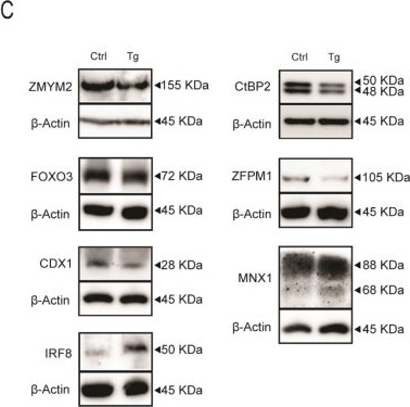Fig.1.C showing Western Blotting in a Homo sapiens (Human) sample from the publication: Endoplasmic reticulum stress regulates the intestinal stem cell state through CtBP2.