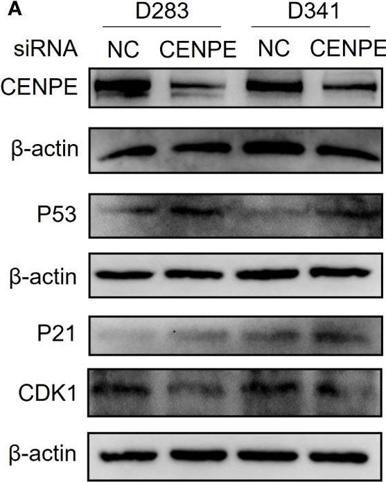 Fig.9.A showing Western Blotting in a Homo sapiens (Human) sample from the publication: Primary microcephaly gene CENPE is a novel biomarker and potential therapeutic target for non-WNT/non-SHH medulloblastoma.