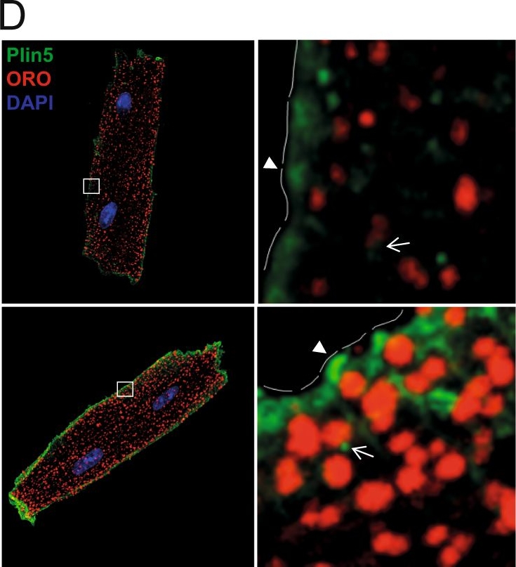 Plin2-deficiency reduces lipophagy and results in increased lipid accumulation in the heart.