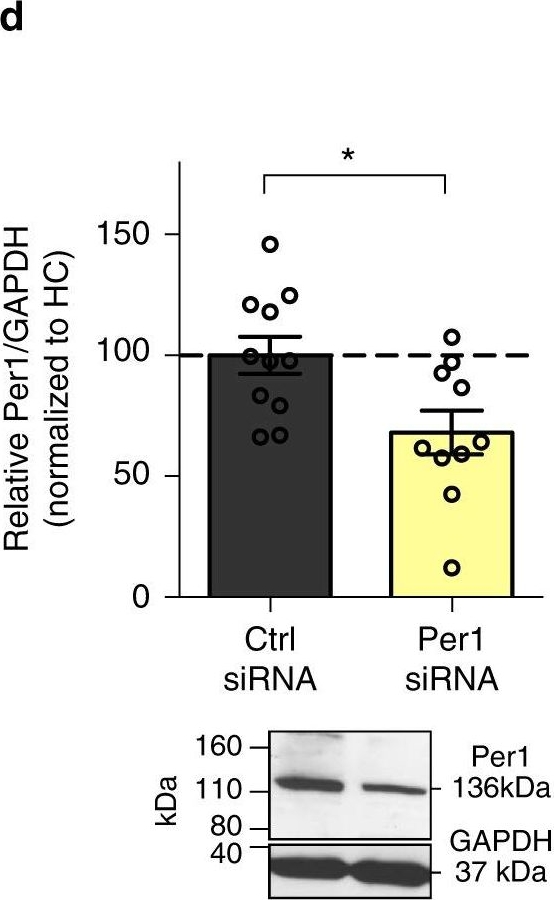 Fig.4.D showing Western Blotting in a Mus musculus (House mouse) sample from the publication: Epigenetic regulation of the circadian gene Per1 contributes to age-related changes in hippocampal memory.