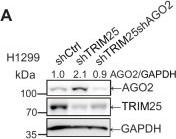 Fig.4.A showing Western Blotting in a Homo sapiens (Human) sample from the publication: Targeting the TRIM25-AGO2-miR-148b-5p-ABCC1 axis overcomes chemoresistance in non-small cell lung cancer.