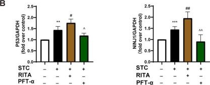 Fig.6.B from the publication: Calcium/P53/Ninjurin 1 Signaling Mediates Plasma Membrane Rupture of Acinar Cells in Severe Acute Pancreatitis.