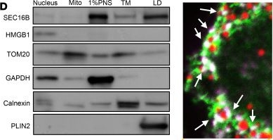 Fig.6.D showing Western Blotting in a Mus musculus (House mouse) sample from the publication: Hepatic SEC16B regulates lipid homeostasis by coordinating VLDL secretion and lipid droplet expansion.