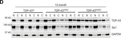 あこページ TDP43 (D9R3L) Rabbit Monoclonal Antibody | Cell Signaling Technology