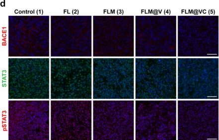 Fig.6.D showing Immunocytochemistry-immunofluorescence from the publication: Metal-Supramolecular Drug Delivery System Empowered Meningeal Lymphatic Vessels-Bridged Intracranial-Peripheral Dual Immune Modulation for Reversing Glioblastoma Immune Suppression.