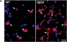 Fig.2.A showing Immunohistochemistry in a Mus musculus (House mouse) sample from the publication: The Bcl-2 Homology-3 Domain (BH3)-Only Proteins, Bid, DP5/Hrk, and BNip3L, Are Upregulated in Reactive Astrocytes of End-Stage Mutant SOD1 Mouse Spinal Cord.