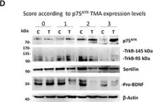 Fig.2.D showing Western Blotting from the publication: p75 neurotrophin receptor and pro-BDNF promote cell survival and migration in clear cell renal cell carcinoma.