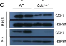 Fig.1.C showing Western Blotting from the publication: Loss of hepatocyte cell division leads to liver inflammation and fibrosis.