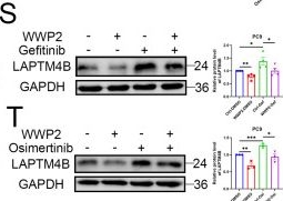 Fig.2.S showing Western Blotting in a Homo sapiens (Human) sample from the publication: LAPTM4B Confers Resistance to EGFR-TKIs by Suppressing the Proteasomal Degradation of ATP1A1 in Non-small Cell Lung Cancer.