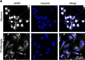 Fig.6.A showing Immunocytochemistry-immunofluorescence in a Homo sapiens (Human) sample from the publication: CRISPRi-based screen of autism spectrum disorder risk genes in microglia uncovers roles of ADNP in microglia endocytosis and synaptic pruning.