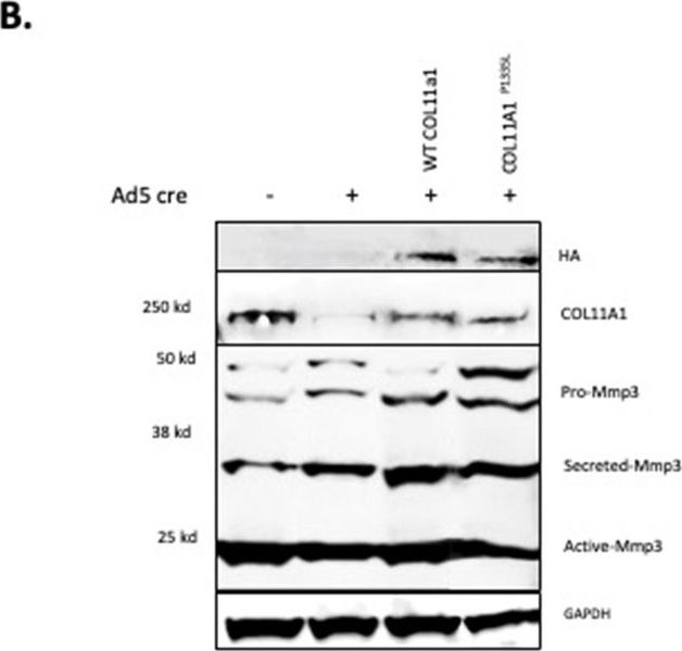 Fig.5.B showing Western Blotting from the publication: Association of genetic variation in COL11A1 with adolescent idiopathic scoliosis.