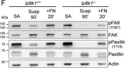 Fig.2.F showing Western Blotting from the publication: Deletion of inositol hexakisphosphate kinase 1 (IP6K1) reduces cell migration and invasion, conferring protection from aerodigestive tract carcinoma in mice.