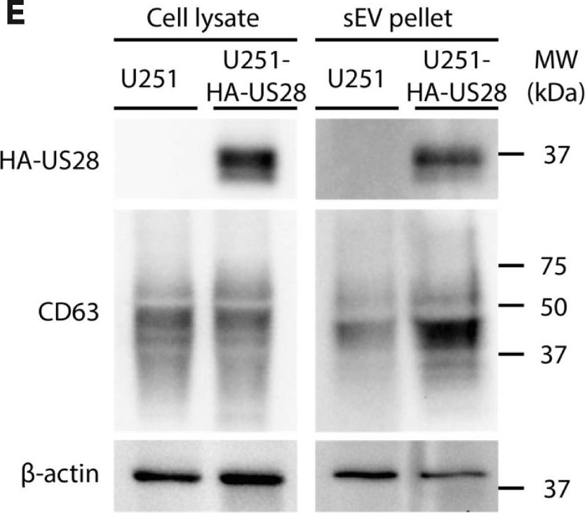 Fig.2.E showing Western Blotting from the publication: Exosomal release of the virus-encoded chemokine receptor US28 contributes to chemokine scavenging.