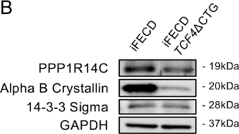 Fig.3.B showing Western Blotting in a Homo sapiens (Human) sample from the publication: TCF4 trinucleotide repeat expansion drives distinct proteomic signatures in Fuchs endothelial corneal dystrophy.