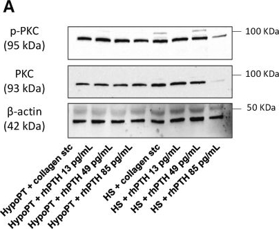 Fig.5.A showing Western Blotting from the publication: PTH-driven modulation of platelet activity via the NOX2 pathway in postsurgical hypoparathyroidism.