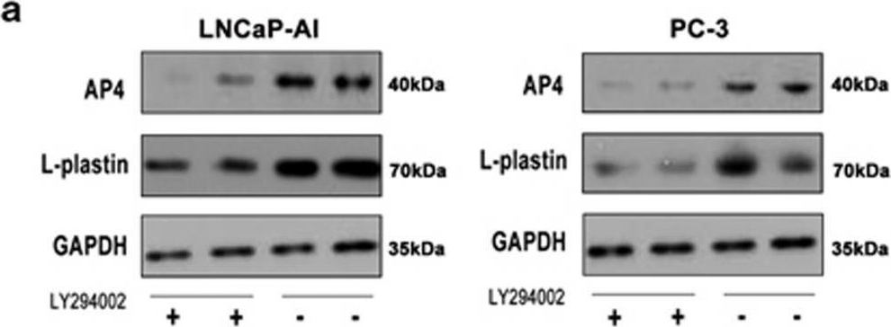 Fig.4.A showing Western Blotting from the publication: AP4 modulated by the PI3K/AKT pathway promotes prostate cancer proliferation and metastasis of prostate cancer via upregulating L-plastin.