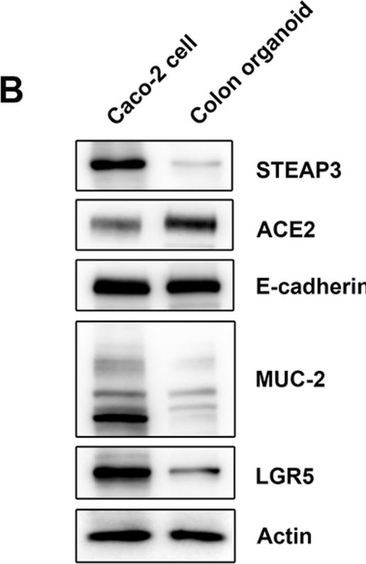 Fig.4.B showing Western Blotting in a Homo sapiens (Human) sample from the publication: Integration of biomimetic organoid-on-chip and 2D models advances the mechanistic Understanding of STEAP3-mediated regulation in intestinal viral infection.