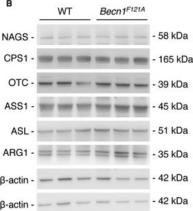 Fig.1.B showing Western Blotting in a Mus musculus (House mouse) sample from the publication: Beclin-1-mediated activation of autophagy improves proximal and distal urea cycle disorders.