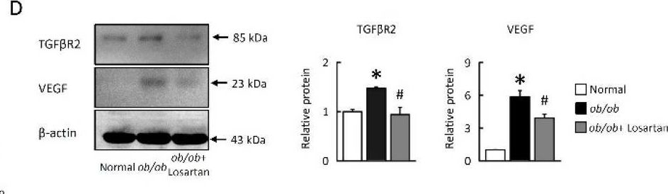 Fig.4.D showing Western Blotting in a Mus musculus (House mouse) sample from the publication: Losartan Attenuates Insulin Resistance and Regulates Browning Phenomenon of White Adipose Tissue in ob/ob Mice.