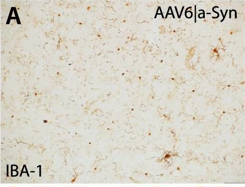 Fig.10.A showing Immunohistochemistry-immunofluorescence in a Rattus norvegicus (Rat) sample from the publication: Novel AAV-based rat model of forebrain synucleinopathy shows extensive pathologies and progressive loss of cholinergic interneurons.