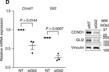 Fig.3.D showing Western Blotting from the publication: KRAS Promotes GLI2-Dependent Transcription during Pancreatic Carcinogenesis.