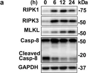 Fig.1.A showing Western Blotting from the publication: RIPK3-MLKL-mediated necroinflammation contributes to AKI progression to CKD.