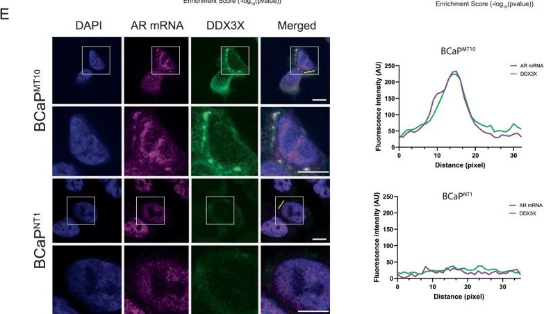 Fig.2.E showing Immunocytochemistry-immunofluorescence in a Homo sapiens (Human) sample from the publication: Molecular insights into DDX3X-androgen receptor mRNA regulation via non-canonical G-quadruplex in castration-resistant prostate cancer.