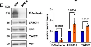 Fig.2.E showing Western Blotting in a Mus musculus (House mouse) sample from the publication: HAPLN1 potentiates peritoneal metastasis in pancreatic cancer.