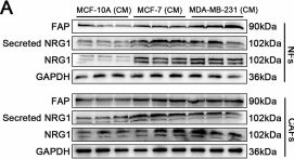 FAP (E1V9V) Rabbit Monoclonal Antibody | Cell Signaling Technology