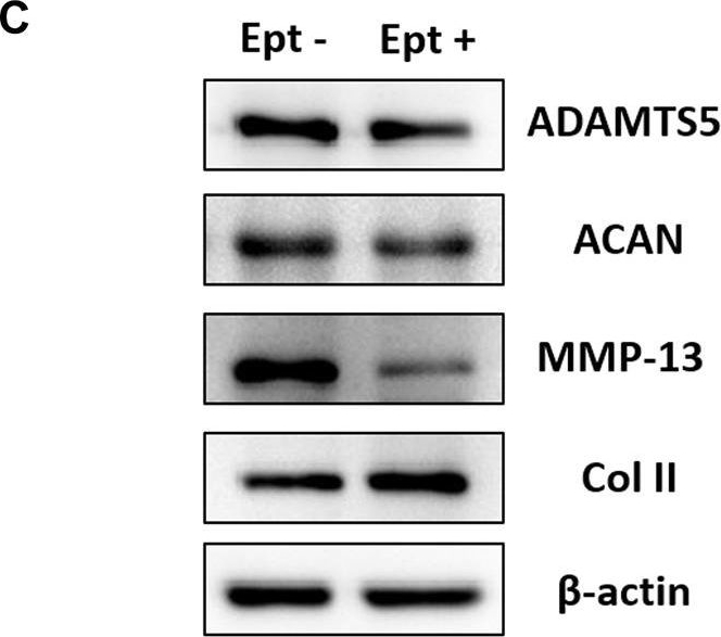 Fig.4.C showing Western Blotting from the publication: Etanercept embedded silk fibroin/pullulan hydrogel enhance cartilage repair in bone marrow stimulation.