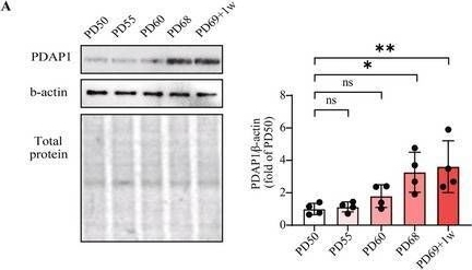 Fig.4.A showing Western Blotting from the publication: Identifying PDAP1 as a Biological Target on Human Longevity: Integration of Mendelian Randomization, Cohort, and Cell Experiments Validation Study.