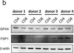 Fig.3.B showing Western Blotting from the publication: GPX4 is a key ferroptosis regulator orchestrating T cells and CAR-T-cells sensitivity to ferroptosis.