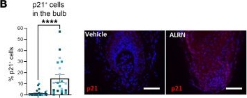Fig.9.B showing Immunohistochemistry-immunofluorescence in a Homo sapiens (Human) sample from the publication: Transient p53/p21 activation selectively protects healthy human hair follicles and their stem cells from chemotherapy.