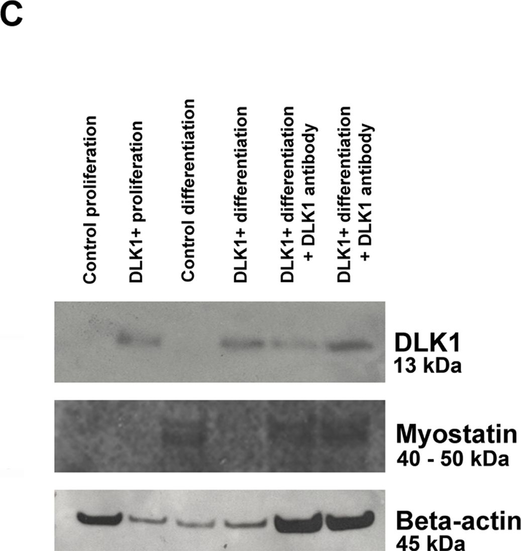 Fig.6.C showing Western Blotting in a Mus musculus (House mouse) sample from the publication: Delta-like 1 homolog (dlk1): a marker for rhabdomyosarcomas implicated in skeletal muscle regeneration.