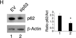 Fig.1.H showing Western Blotting from the publication: p53-R273H Sustains ROS, Pro-Inflammatory Cytokine Release and mTOR Activation While Reducing Autophagy, Mitophagy and UCP2 Expression, Effects Prevented by wtp53.